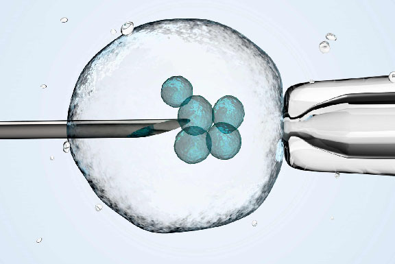 Image for Medical Tourists article showing a photograph of stem cell research with a needle in a single cell.